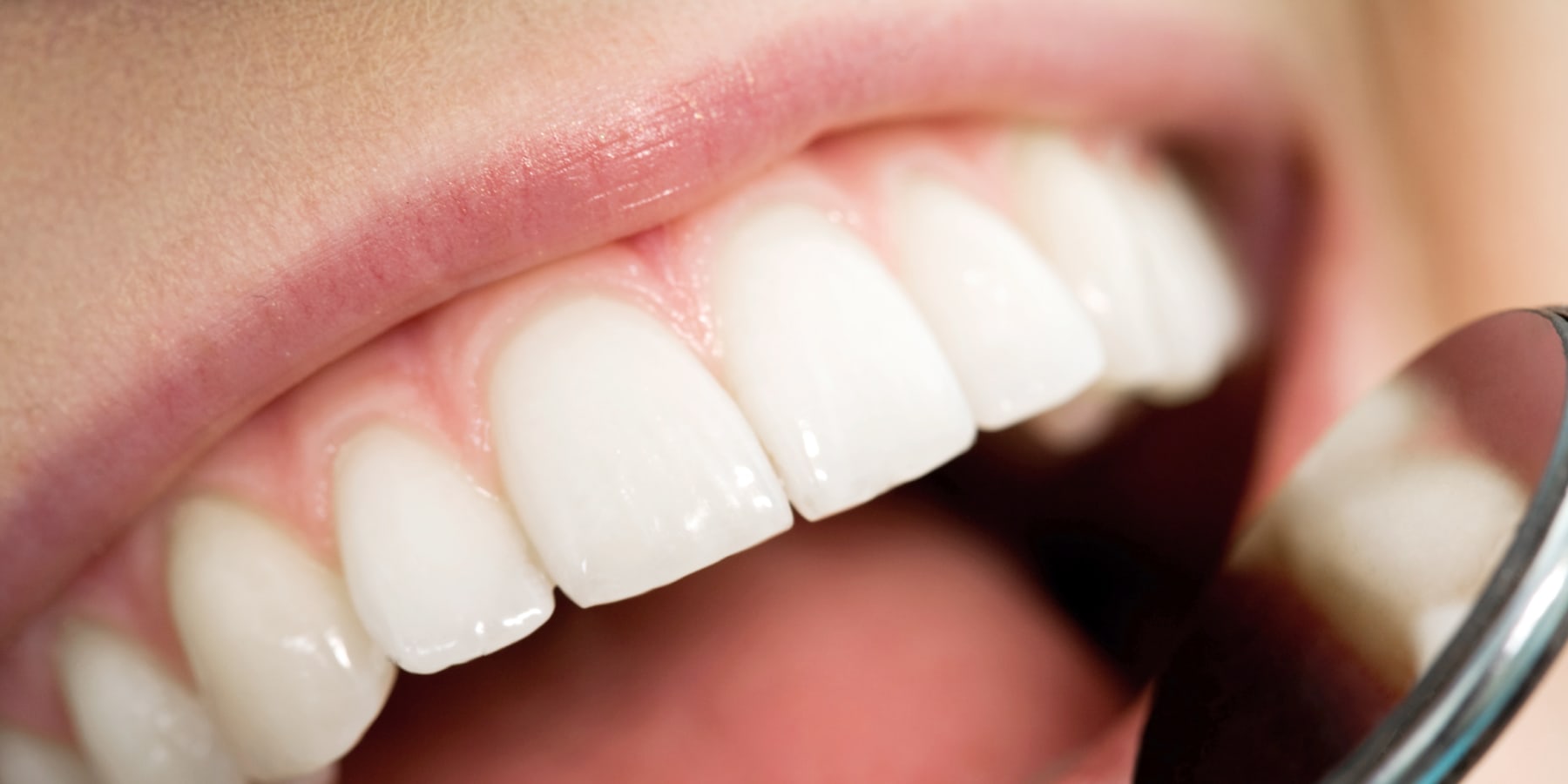 лечение шатающихся передних зубов 