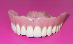 Фото 8. Съемные зубные протезы