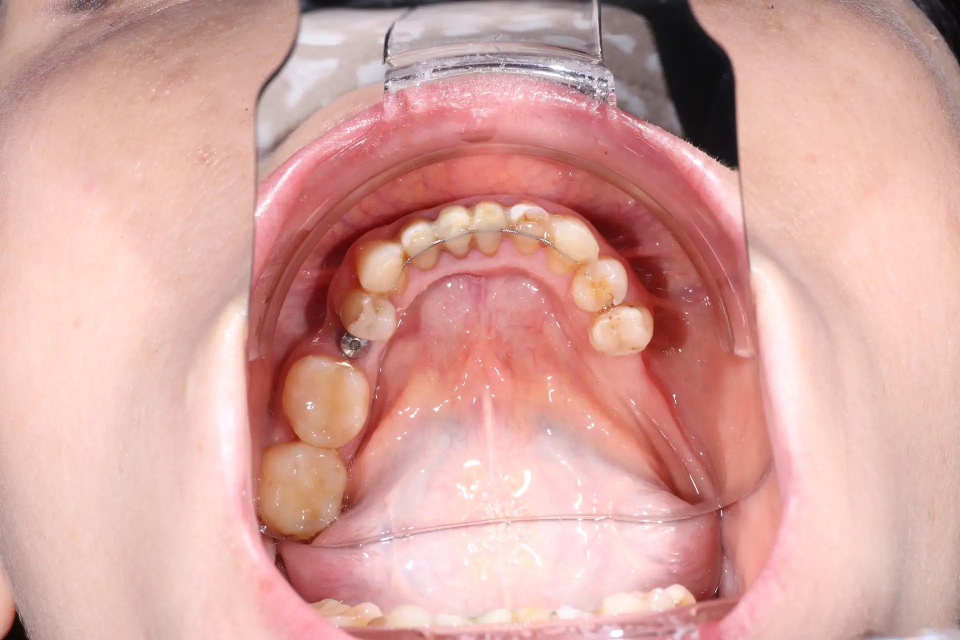 До