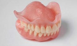 Фото 2. Съемные зубные протезы