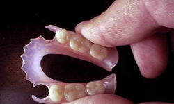 Фото 3. Съемные зубные протезы