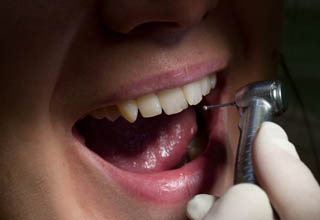 Фото 7. Восстановление зубов