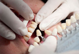Фото 11. Восстановление зубов