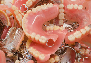 Фото 3. Съемные зубные протезы