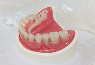 Фото 7. Съемные зубные протезы