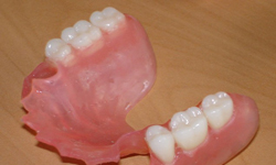 Фото 11. Съемные зубные протезы