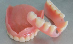 Фото 1. Съемные зубные протезы