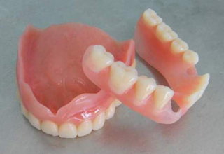 Фото 5. Протезирование зубов