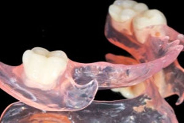 съемный зубной протез на нижнюю челюсть