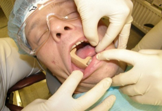Фото 3. Лечение зубов во сне