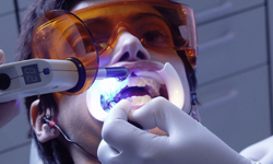 Фото 7. Лазерное отбеливание зубов