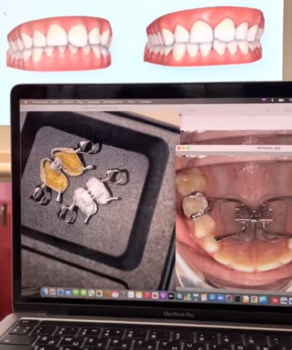 моделирование в стоматологии 