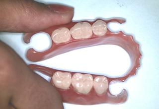 Фото 4. Cъемные зубные протезы