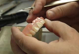 Фото 3. Ремонт зубных протезов
