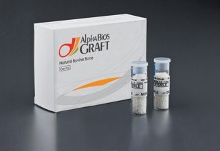 Фото 2. Импланты Alpha Bio