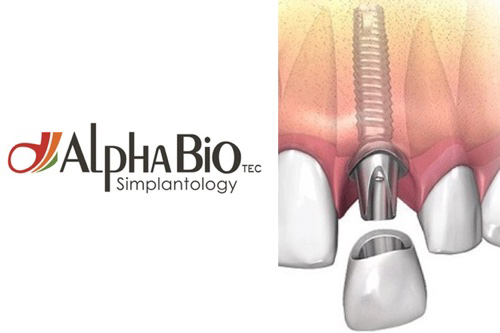 Фото 5. Импланты Alpha Bio