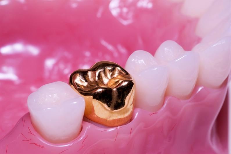 Имплантация 1 зуба коронкой