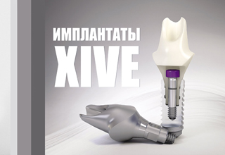 Фото 2. Импланты Xive